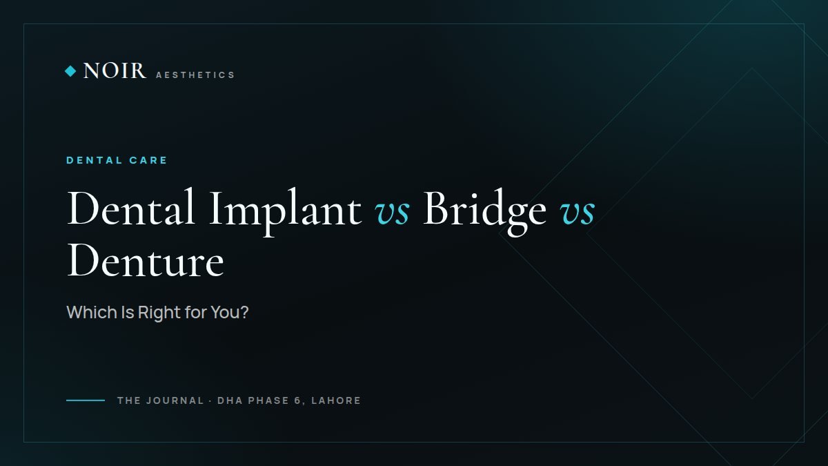 Noir Aesthetics journal cover: Dental implant vs bridge vs denture, which is right for you