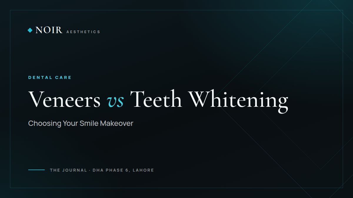 Noir Aesthetics journal cover: Veneers vs teeth whitening, choosing your smile makeover